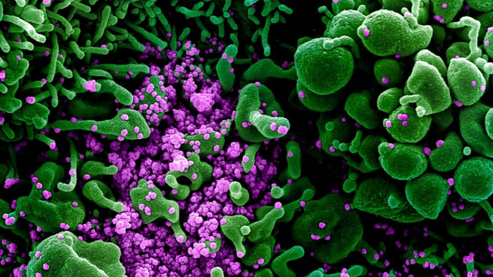 Bámulatos elektronmikroszkópos képek: így fertőzi a sejteket a koronavírus