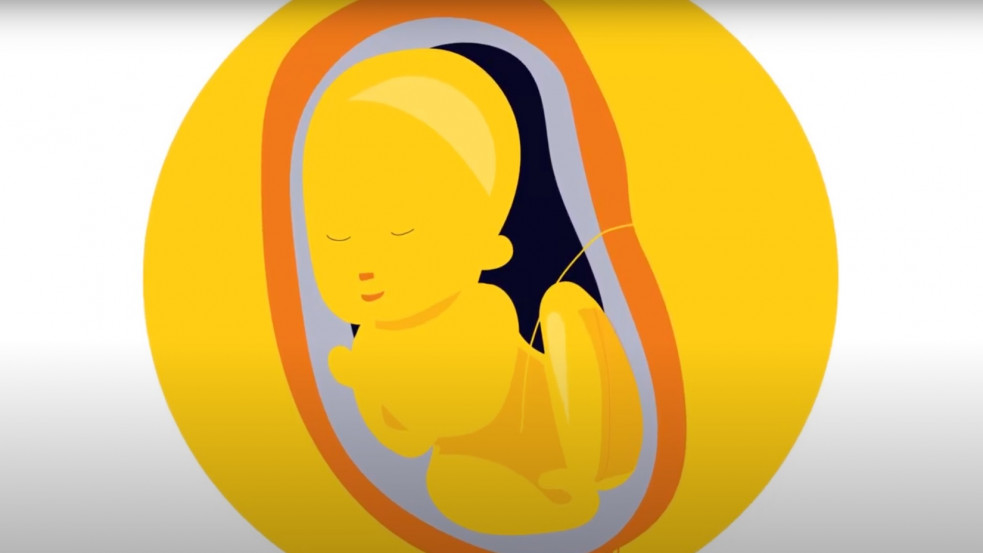 Kőkemény videó az abortuszról: naponta 73 magzatot vetetnek el Magyarországon