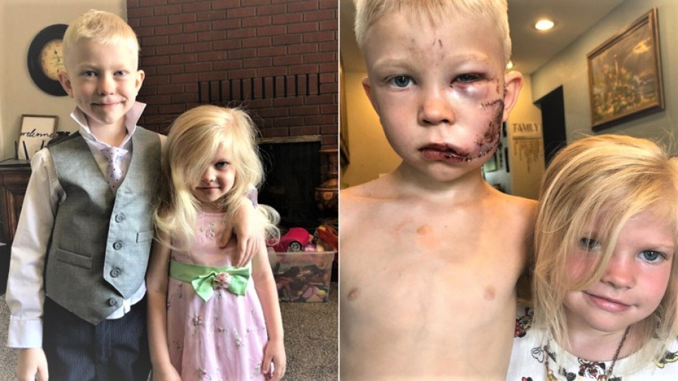 Kis hős, hatalmas szívvel: mérges kutyától védte meg húgát egy 6 éves kisfiú 