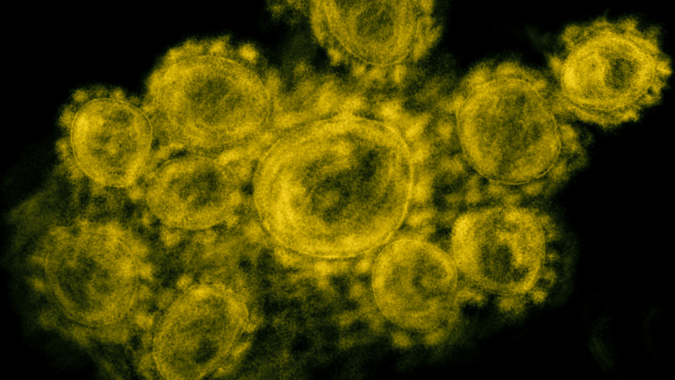 Maximum 10 kilót nyom a világban található összes fertőző koronavírus