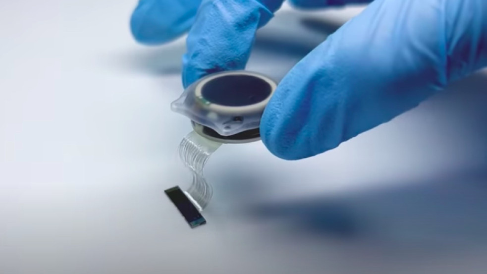 Élőben közvetítené Elon Musk cége egy chip emberi agyba ültetését
