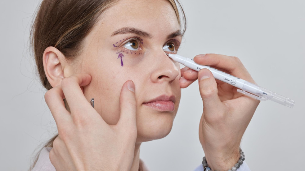 Egyre több embert érint a fedeles szem jelensége (x)