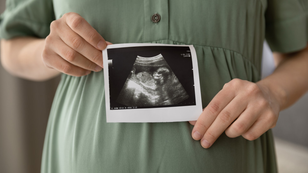 Nem használhatják a „magzati szívverés” és a „késői abortusz” kifejezéseket az Associated Press újságírói