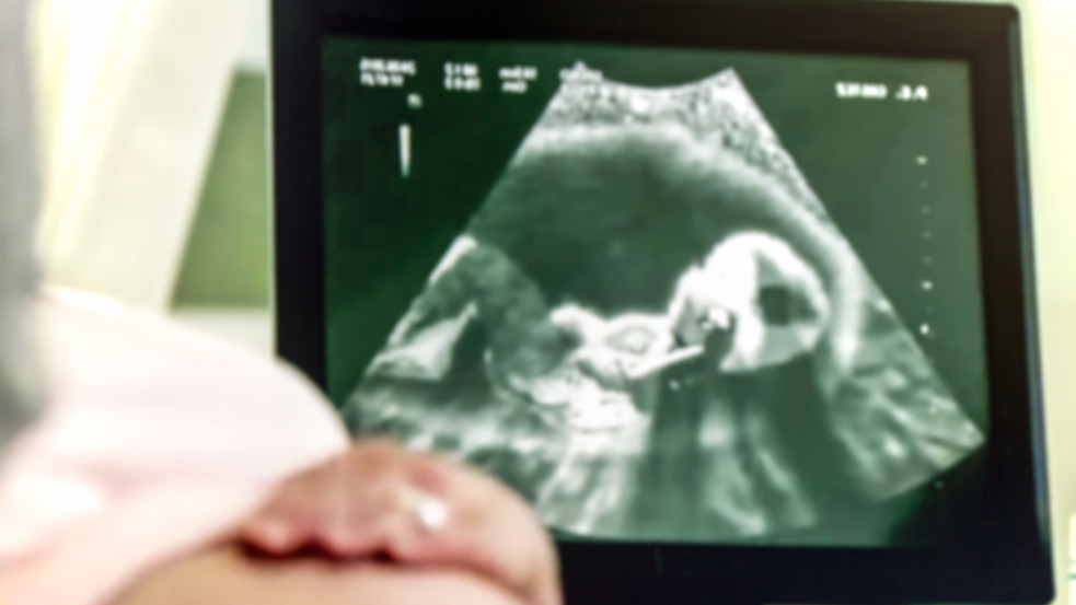 Oklahomában betiltották az abortuszt, ha már észlelni lehet a magzat szívverését
