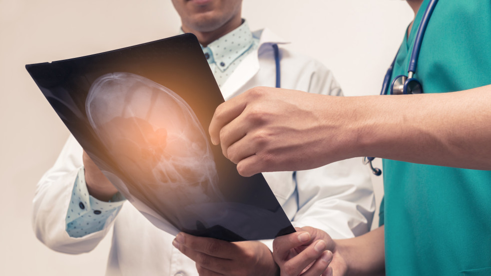 Dermesztő felfedezés: évtizedeken át élt egy tűvel az agyában egy 80 éves orosz nő